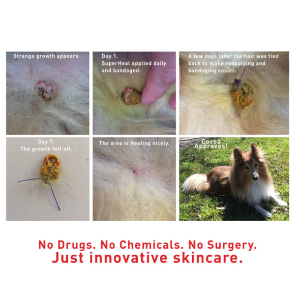 Augustine’s SuperHeal