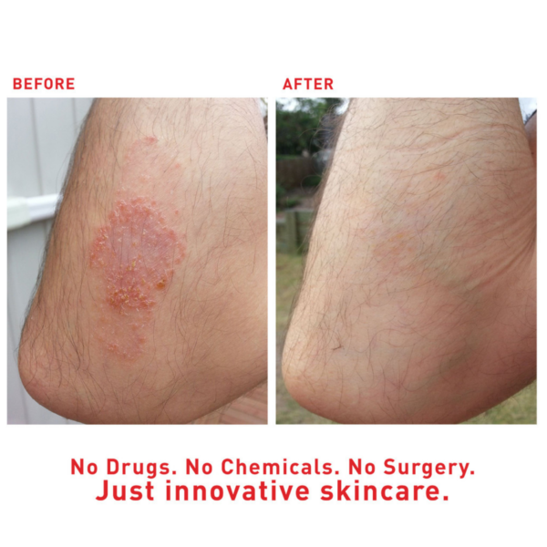 Augustine's SuperHeal