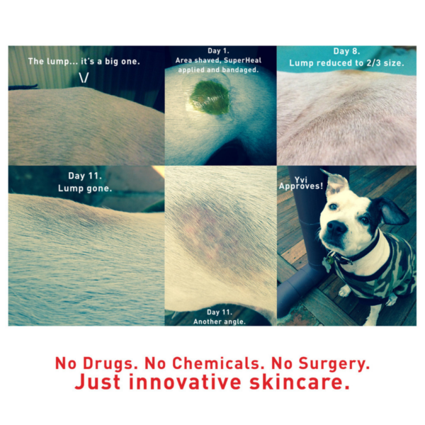 Augustine's SuperHeal