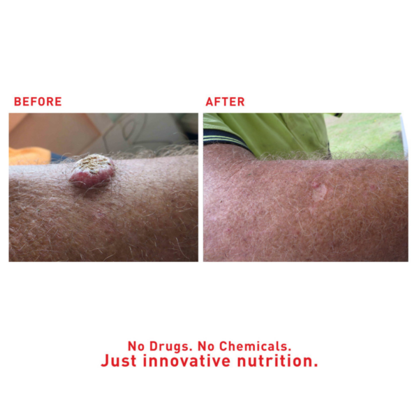 Augustine’s SuperHeal