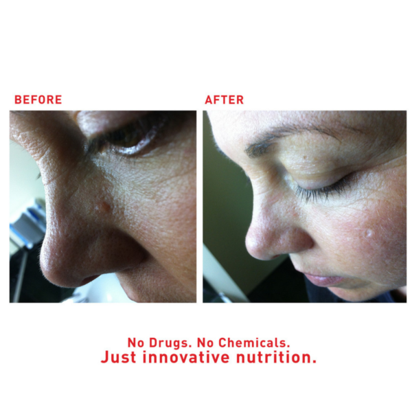 Augustine's SuperHeal